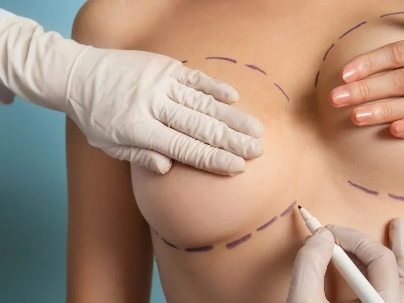 چگونه باید برای جراحی ژنیکوماستی آماده شوید؟