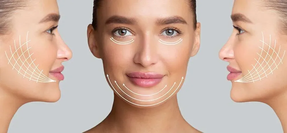 لیفت با نخ برای صورت (Thread Lift): راه‌حل لیفت صورت غیرجراحی