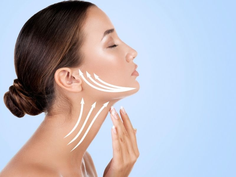 neck lift