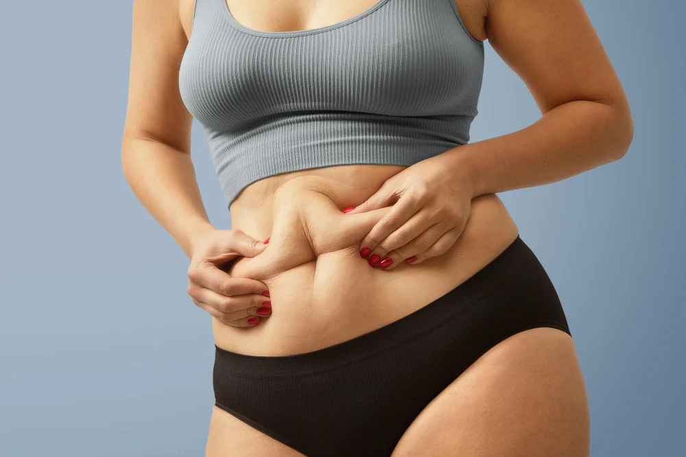 Liposuction for belly fat removal