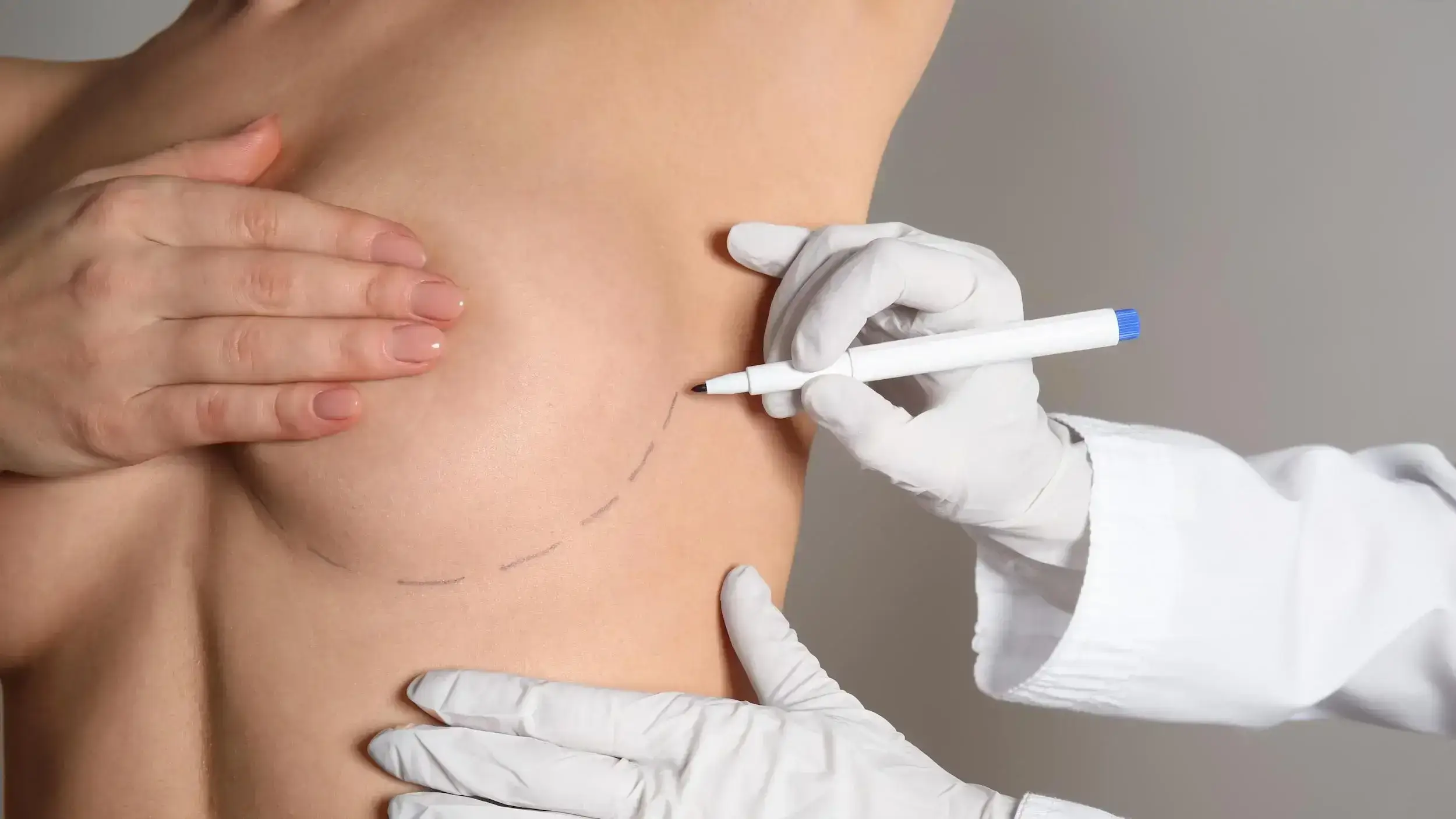 Natural breast aesthetics