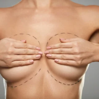 breast aesthetics