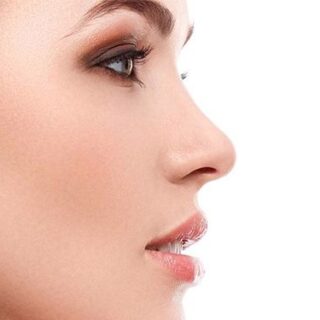 rhinoplasty